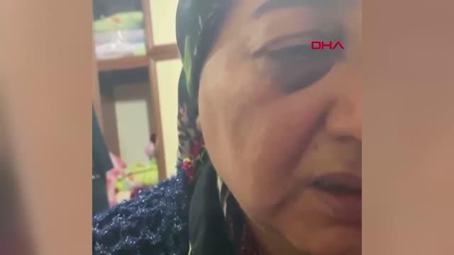 kocaeli esini gozleri morarincaya kadar dovup 13982245 o