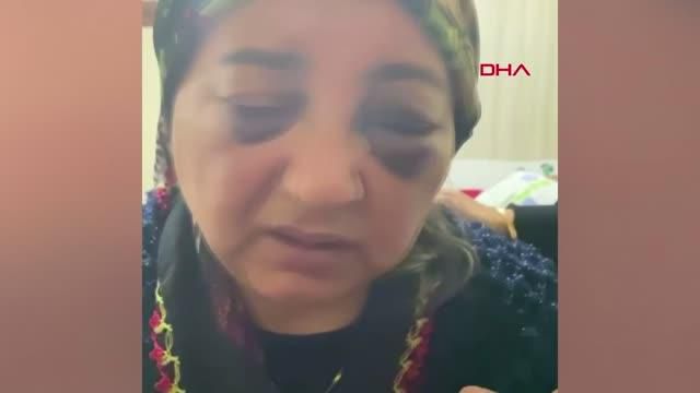 kocaeli esini gozleri morarincaya kadar dovup 4 13982245 o