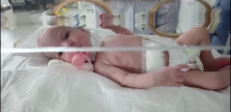 Bağırsak tıkanıklığı ile doğan bebek ameliyatla sağlığına kavuştu