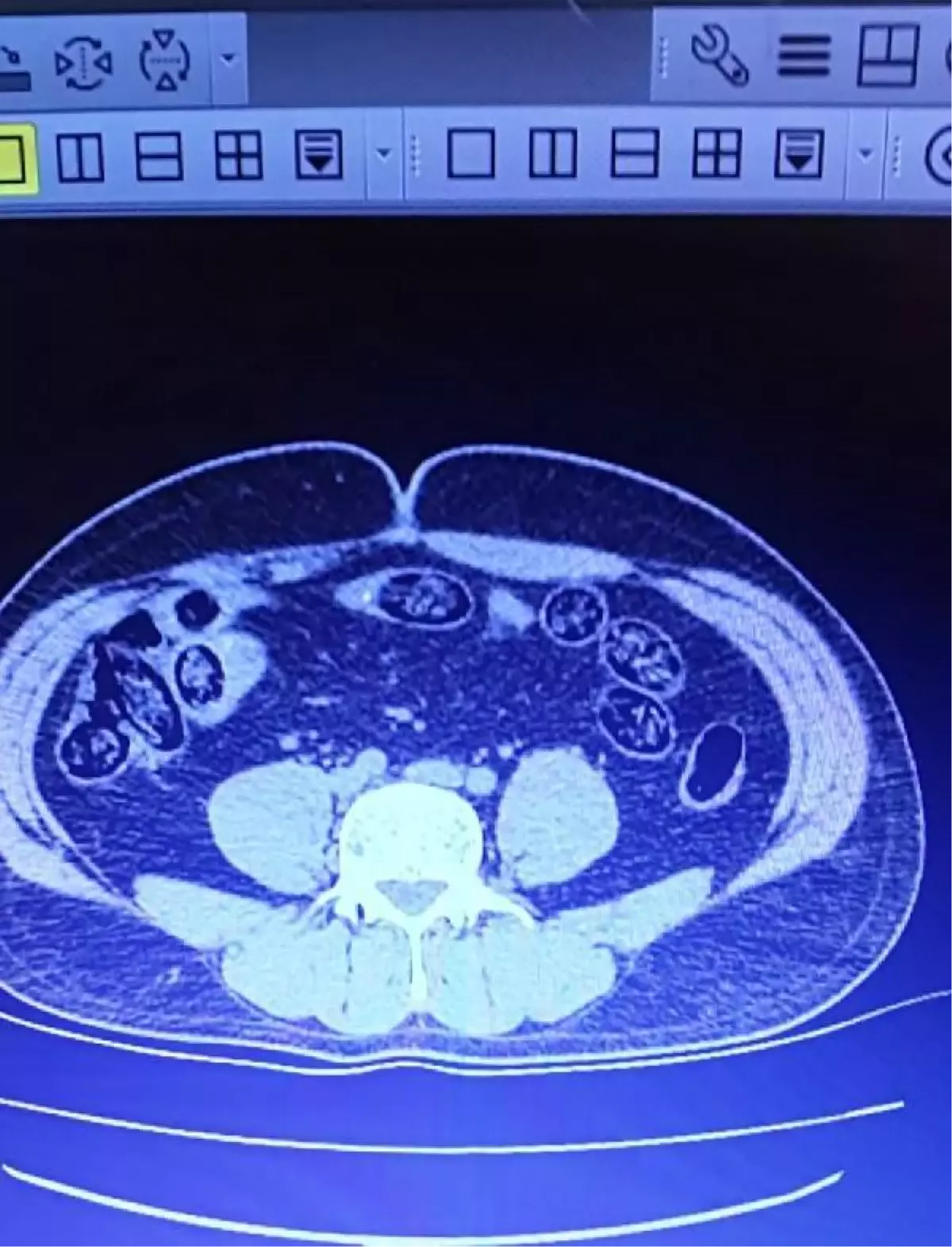 Son dakika haberleri | Van'da, 2 İran uyruklunun midesinden 103 kapsül metamfetamin çıktı