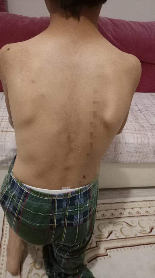 Hemşire, köpeklerle oynayan 3 çocuğu tırmıkla darbetti