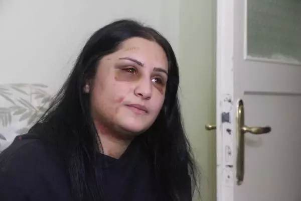 Kızının gözü önünde eski eşini döven İbrahim Zarap hakkında iddianame hazırlandı