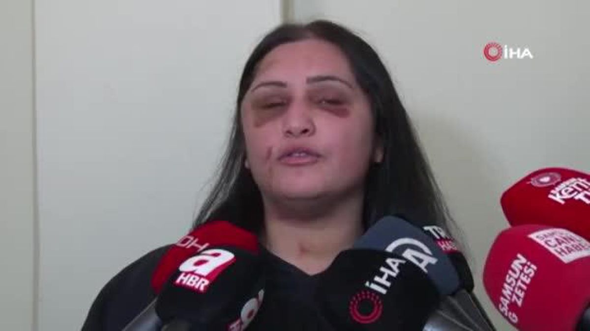 Samsun'daki kadına şiddet olayının iddianamesi kabul edildi