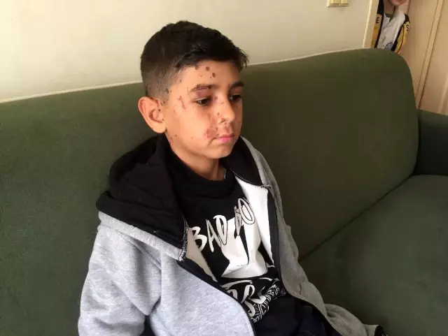Arkadaşının attığı temizlik maddesi kör ediyordu Arkadaşının attığı temizlik maddesi kör ediyordu