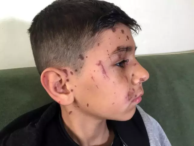 Arkadaşının attığı temizlik maddesi kör ediyordu Arkadaşının attığı temizlik maddesi kör ediyordu