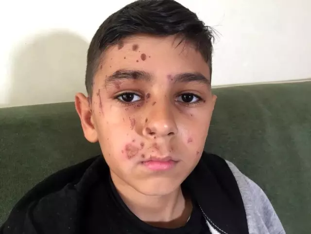 Arkadaşının attığı temizlik maddesi kör ediyordu Arkadaşının attığı temizlik maddesi kör ediyordu