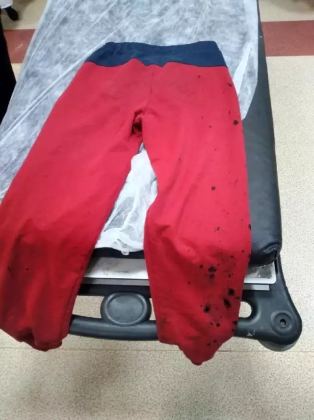 Arkadaşının attığı temizlik maddesi kör ediyordu Arkadaşının attığı temizlik maddesi kör ediyordu
