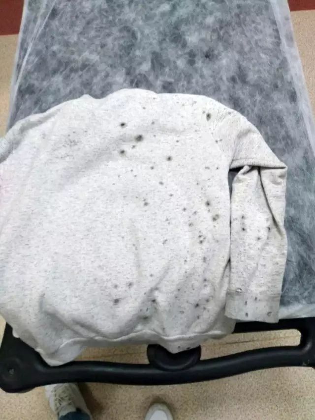Arkadaşının attığı temizlik maddesi kör ediyordu Arkadaşının attığı temizlik maddesi kör ediyordu