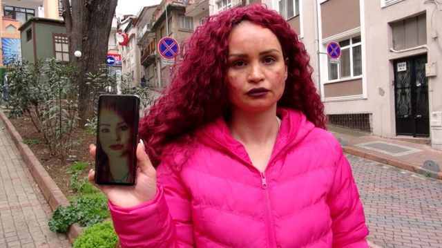yuzundeki lekeleri sildirmek icin gitti hayat 5 14022591 o