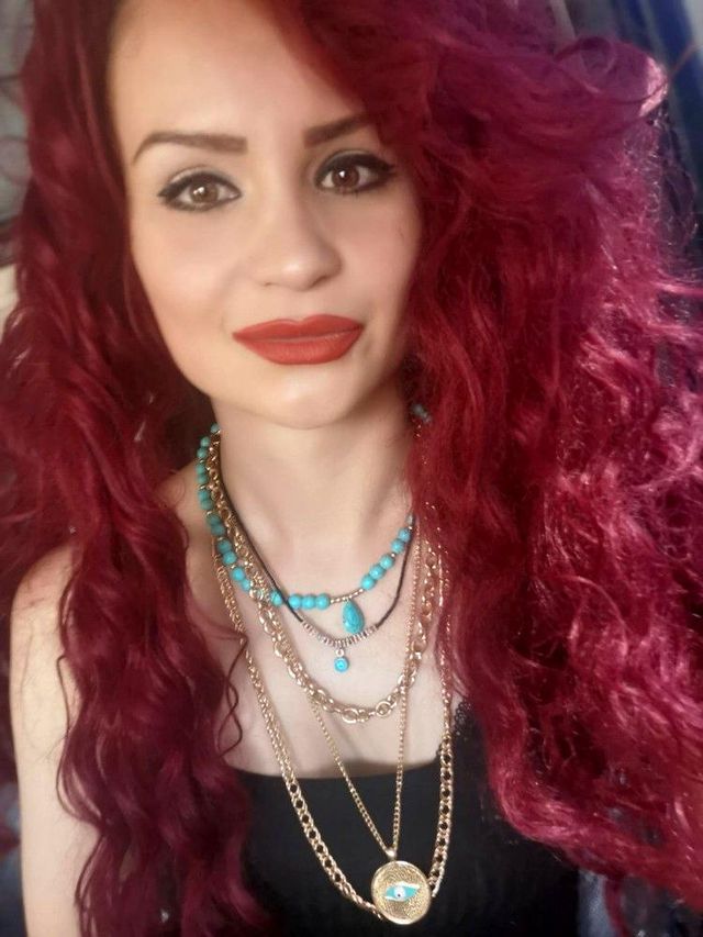 yuzundeki lekeleri sildirmek icin gitti hayat 7 14022591 o