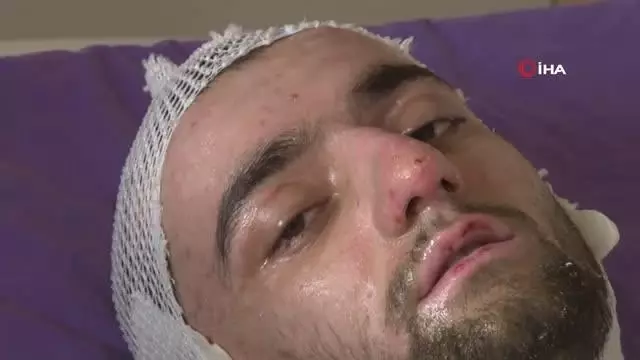 Banyo yapmak için sobaya benzin döktü, feci şekilde yandı Banyo yapmak için sobaya benzin döktü, feci şekilde yandı