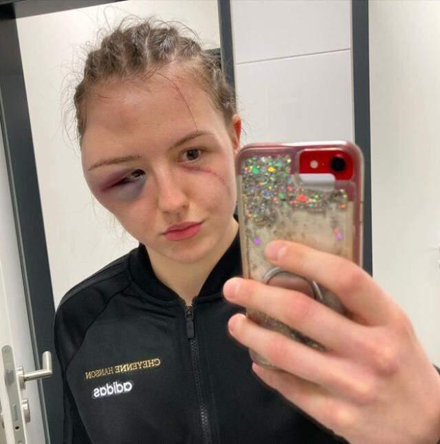 In the women's belt match, the German boxer whose face became unrecognizable did not give up and won the match.