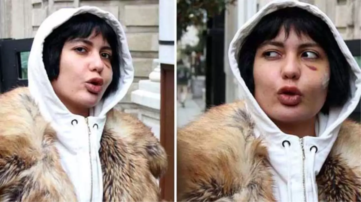 Saldırıya uğrayan Bahar Candan, olayın detaylarını anlattı