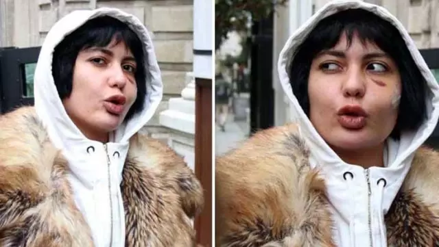 Saldırıya uğrayan Bahar Candan, olayın detaylarını anlattı Saldırıya uğrayan Bahar Candan, olayın detaylarını anlattı