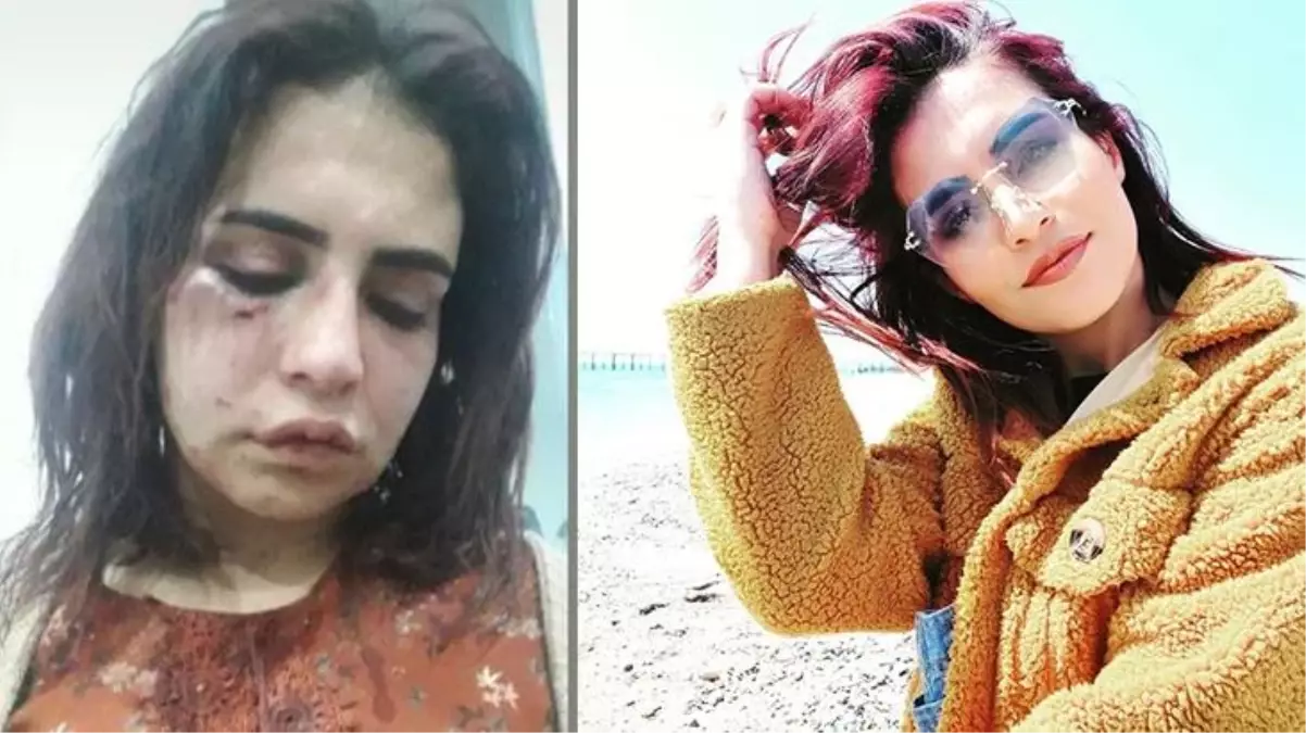 Eski sevgilisi tarafından öldüresiye dövülen Beyza'dan yardım çığlığı: Ölmek istemiyorum