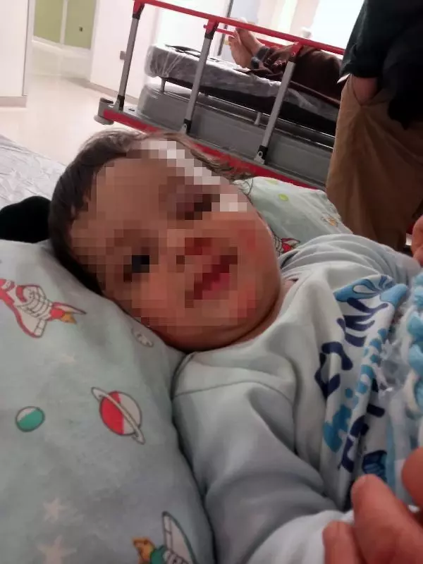 ADANA Yürüteçle merdivenden düşen Asaf bebek, başından
