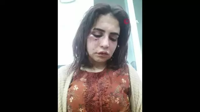 Alanya'da genç kadını darp eden eski sevgili tutuklandı Alanya'da genç kadını darp eden eski sevgili tutuklandı