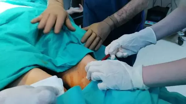KÖK HÜCRE TEDAVİSİNDEKİ BAŞARIYLA, DİYARBAKIR'A SAĞLIKTA TERSİNE GÖÇ KÖK HÜCRE TEDAVİSİNDEKİ BAŞARIYLA, DİYARBAKIR'A SAĞLIKTA TERSİNE GÖÇ
