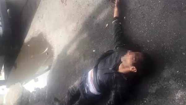Sapık, 'Karlos' adlı köpeğin bacağından ısırmasıyla yakalandı (2) Sapık, 'Karlos' adlı köpeğin bacağından ısırmasıyla yakalandı (2)