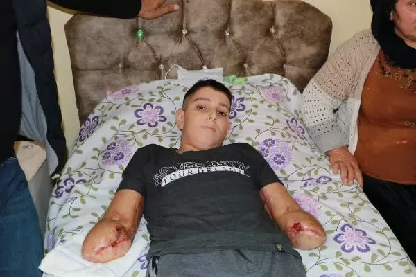 ADANA TELLERE TAKILAN UÇURTMASINI ALIRKEN AKIMA KAPILAN FURKAN, PROTEZ İÇİN YARDIM BEKLİYOR ADANA TELLERE TAKILAN UÇURTMASINI ALIRKEN AKIMA KAPILAN FURKAN, PROTEZ İÇİN YARDIM BEKLİYOR