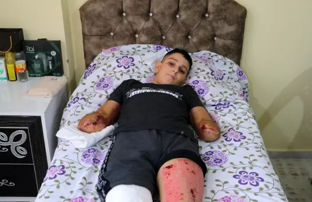 Son dakika haberleri | Uçurtması yüksek gerilim hattına takılan çocuk ölümden döndü Son dakika haberleri | Uçurtması yüksek gerilim hattına takılan çocuk ölümden döndü