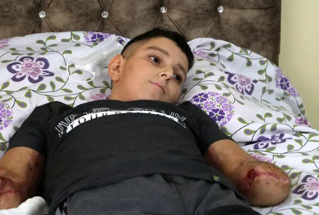 Son dakika haberleri | Uçurtması yüksek gerilim hattına takılan çocuk ölümden döndü Son dakika haberleri | Uçurtması yüksek gerilim hattına takılan çocuk ölümden döndü