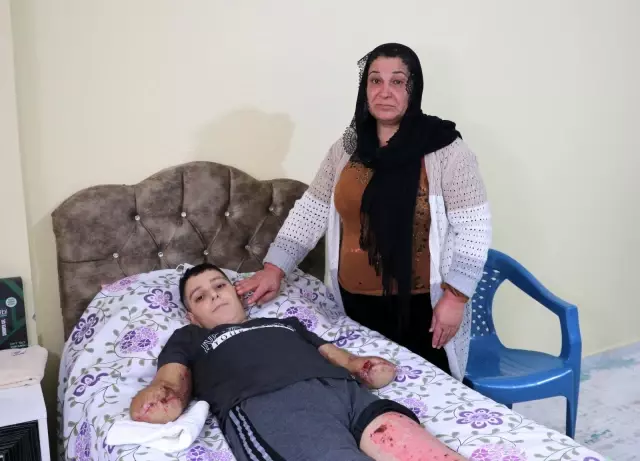 Son dakika haberleri | Uçurtması yüksek gerilim hattına takılan çocuk ölümden döndü Son dakika haberleri | Uçurtması yüksek gerilim hattına takılan çocuk ölümden döndü