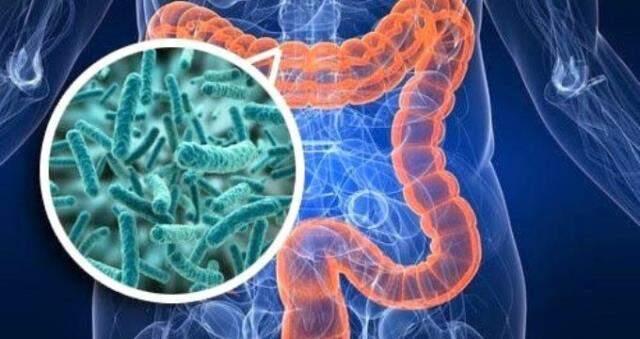 Geçirgen bağırsak sendromu nedir? Geçirgen bağırsak sendromu nedeni ve belirtileri nelerdir? Geçirgen bağırsak sendromu tedavi yöntemi nedir?