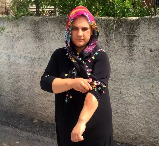 Kapkaççının sürüklediği kadın dehşet anlarını anlattı Kapkaççının sürüklediği kadın dehşet anlarını anlattı