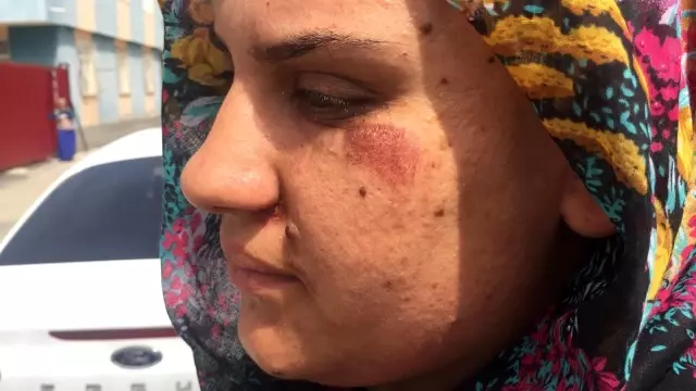 Kapkaççının sürüklediği kadın dehşet anlarını anlattı Kapkaççının sürüklediği kadın dehşet anlarını anlattı