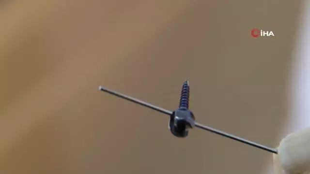 Bu buluş diş hekimlerinin işini kolaylaştıracak Bu buluş diş hekimlerinin işini kolaylaştıracak