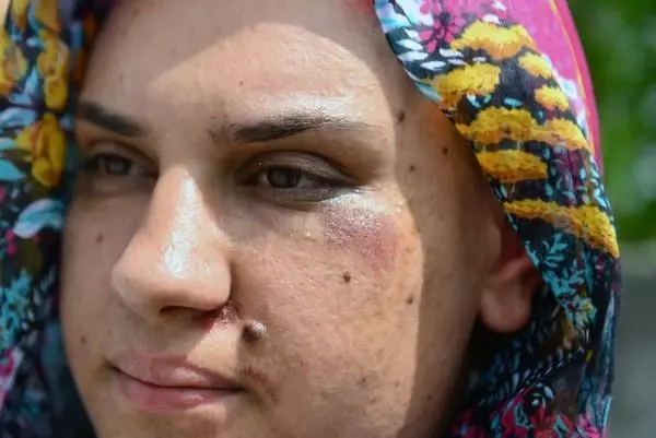 Polis, 2 kardeşi aracıyla sürükleyen şüpheliyi cep telefonu satış ilanıyla yakalamış Polis, 2 kardeşi aracıyla sürükleyen şüpheliyi cep telefonu satış ilanıyla yakalamış