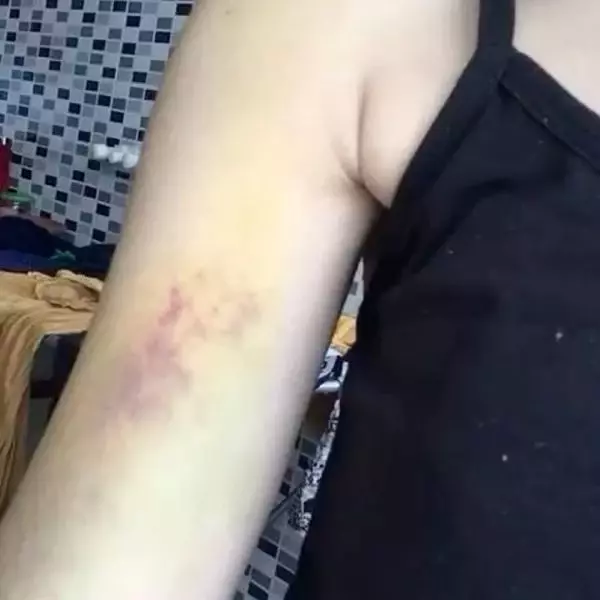 Eski sevgilisinden şiddet gördüğünü iddia eden Gülsüm: Öldürülen kadınlardan olmak istemiyorum Eski sevgilisinden şiddet gördüğünü iddia eden Gülsüm: Öldürülen kadınlardan olmak istemiyorum