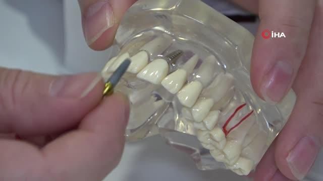 kayip disleriniz icin implant tedavisi tercih 2 14064967 o
