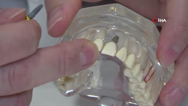 kayip disleriniz icin implant tedavisi tercih 3 14064967 o