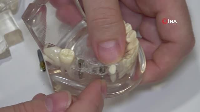kayip disleriniz icin implant tedavisi tercih 4 14064967 o