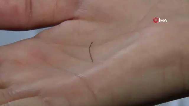 Kokoreç yerken diline iğne batan kadın doktorları da şaşırttı Kokoreç yerken diline iğne batan kadın doktorları da şaşırttı
