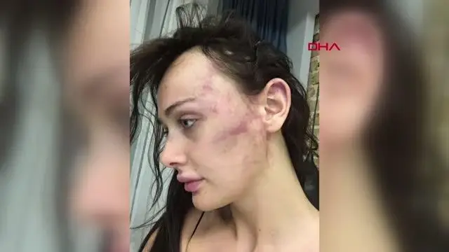 Sırp model Tanja Dukiç'i saatlerce darp eden yönetmen Çağrı Reşat Mehmet Tortop'un foyası ortaya çıktı Sırp model Tanja Dukiç'i saatlerce darp eden yönetmen Çağrı Reşat Mehmet Tortop'un foyası ortaya çıktı