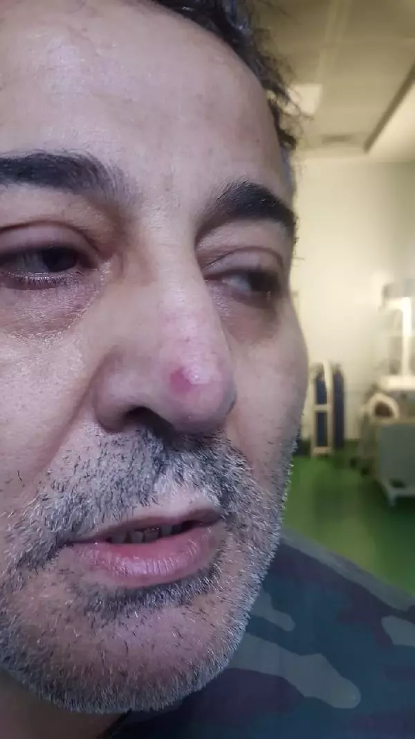 Doktor, hasta yakınının yumruklu saldırısında yaralandı