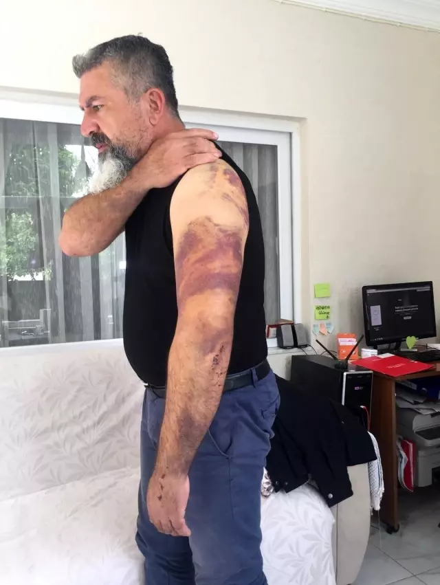 Karşı yönden gelen traktör aracını biçti, kaza sonrası öldüresiye dayak yedi Karşı yönden gelen traktör aracını biçti, kaza sonrası öldüresiye dayak yedi