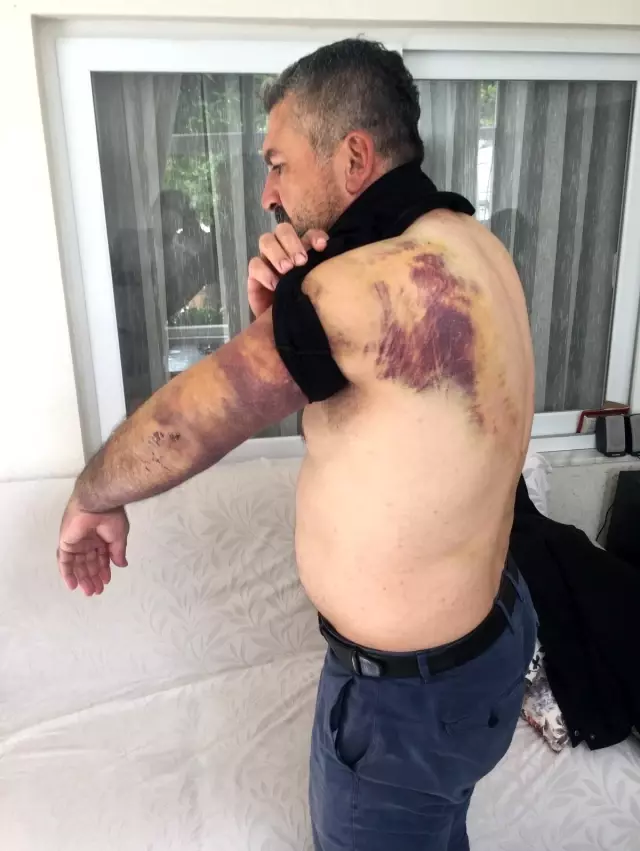 Karşı yönden gelen traktör aracını biçti, kaza sonrası öldüresiye dayak yedi Karşı yönden gelen traktör aracını biçti, kaza sonrası öldüresiye dayak yedi