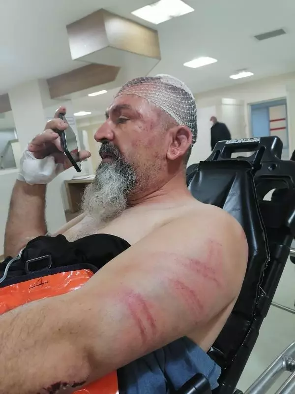 TRAKTÖRLE ÇARPIŞAN OTOMOBİLİN SÜRÜCÜSÜ: PUSUYA DÜŞÜRÜLÜP, DARBEDİLDİM TRAKTÖRLE ÇARPIŞAN OTOMOBİLİN SÜRÜCÜSÜ: PUSUYA DÜŞÜRÜLÜP, DARBEDİLDİM