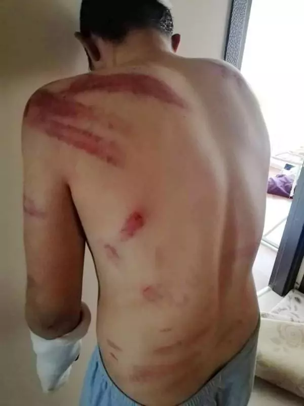 Saatlerce dayak yediği sanıkların serbest bırakılmasına tepki gösterdi Saatlerce dayak yediği sanıkların serbest bırakılmasına tepki gösterdi