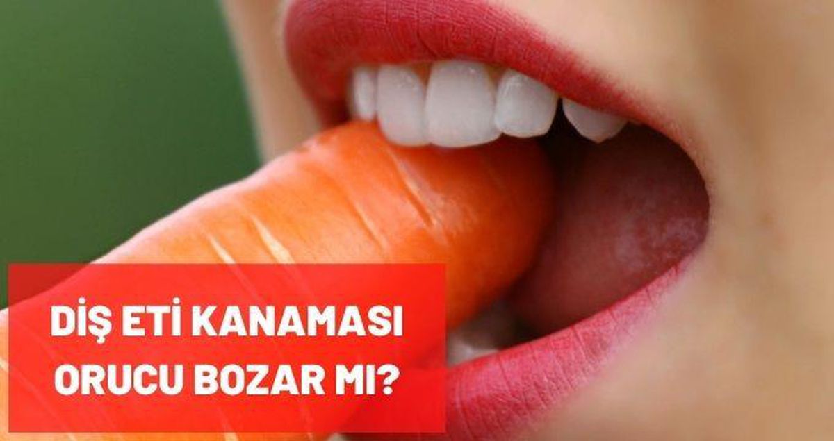 Diş eti kanaması orucu bozar mı? Orucu bozan durumlar nelerdir?