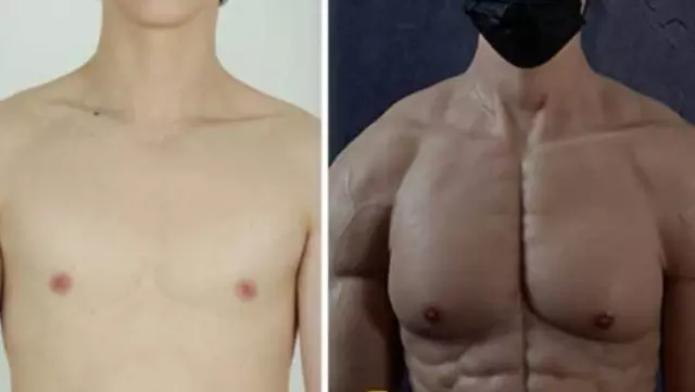Erkeklere dev hizmet! Kusursuz kaslı vücut artık hayal değil, üstelik sporsuz, ameliyatsız Erkeklere dev hizmet! Kusursuz kaslı vücut artık hayal değil, üstelik sporsuz, ameliyatsız