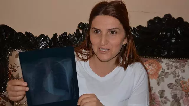Kalp sağda olur mu? Kalp sağda olur mu?