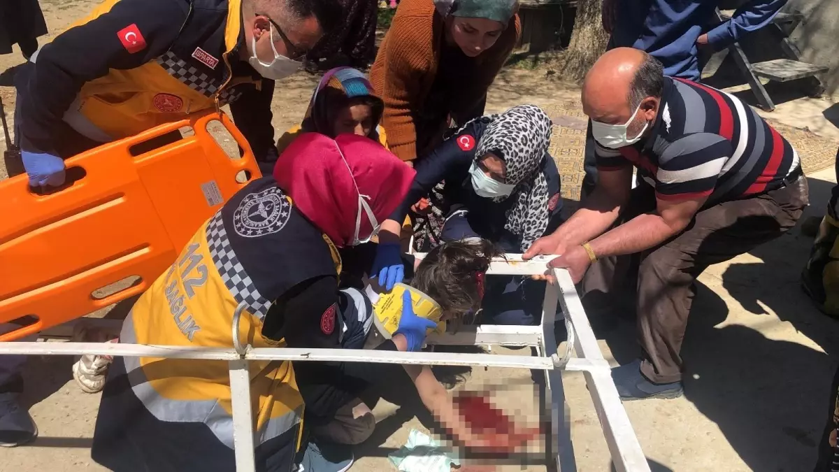 Oyun oynarken üzerine demir askılık düştü: Kanca kafasına saplandı