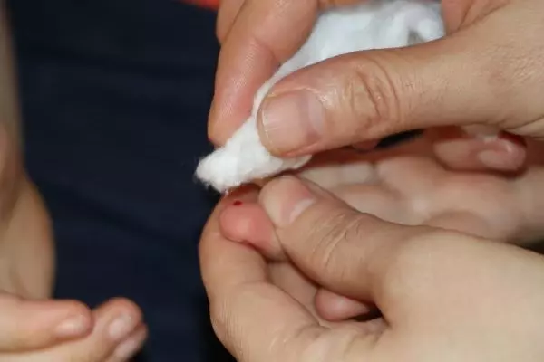 Son dakika haberleri! ADANA ŞEKER ÖLÇÜMÜ İÇİN SÜREKLİ PARMAKLARI DELİNEN ÇOCUKLAR SENSÖR DESTEĞİ İSTİYOR Son dakika haberleri! ADANA ŞEKER ÖLÇÜMÜ İÇİN SÜREKLİ PARMAKLARI DELİNEN ÇOCUKLAR SENSÖR DESTEĞİ İSTİYOR