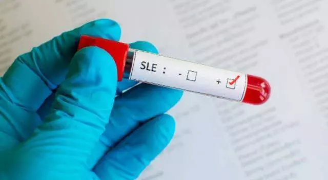 Kelebek hastalığı nedir? Kelebek hastalığı belirtileri nelerdir? Kelebek hastalığı nedir? Kelebek hastalığı belirtileri nelerdir?