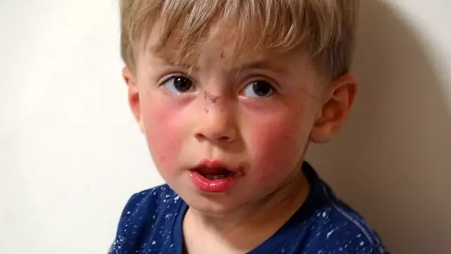 Son dakika haberi | 22 saat sonra bulunan çocuk hastanede müşahedeye alındı Son dakika haberi | 22 saat sonra bulunan çocuk hastanede müşahedeye alındı